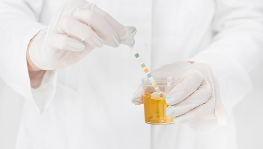 urine drug test results