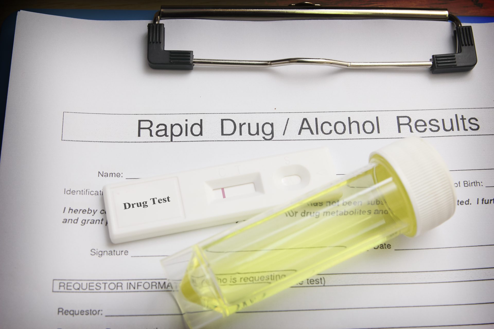 Why Using Accurate Drug Tests is So Important in Today's World Drug