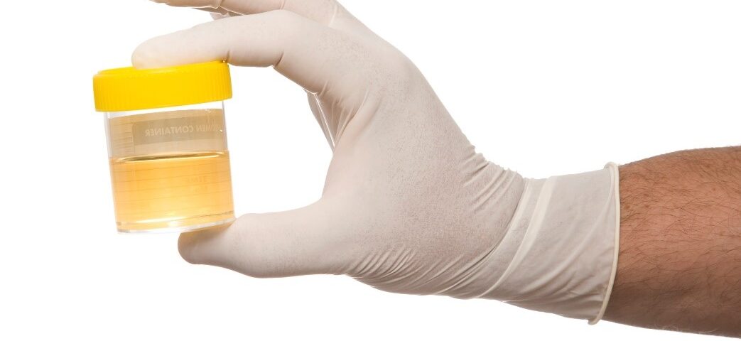 The Importance of Pre-Employment Drug Testing