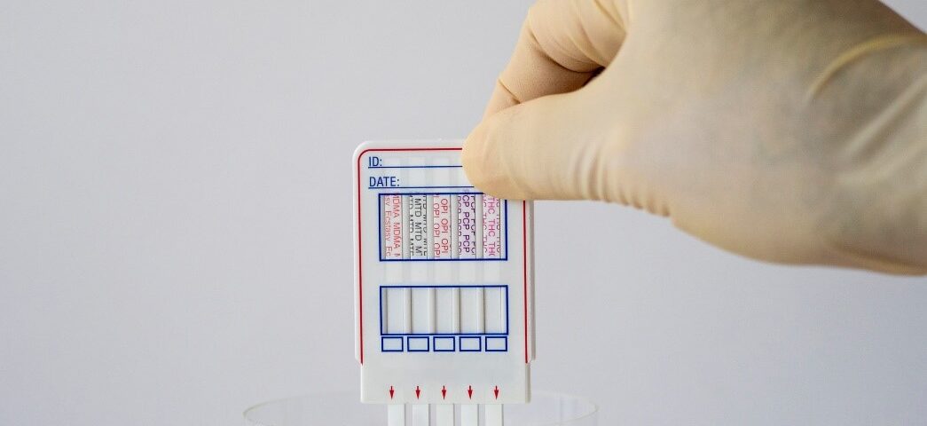 drug test sample